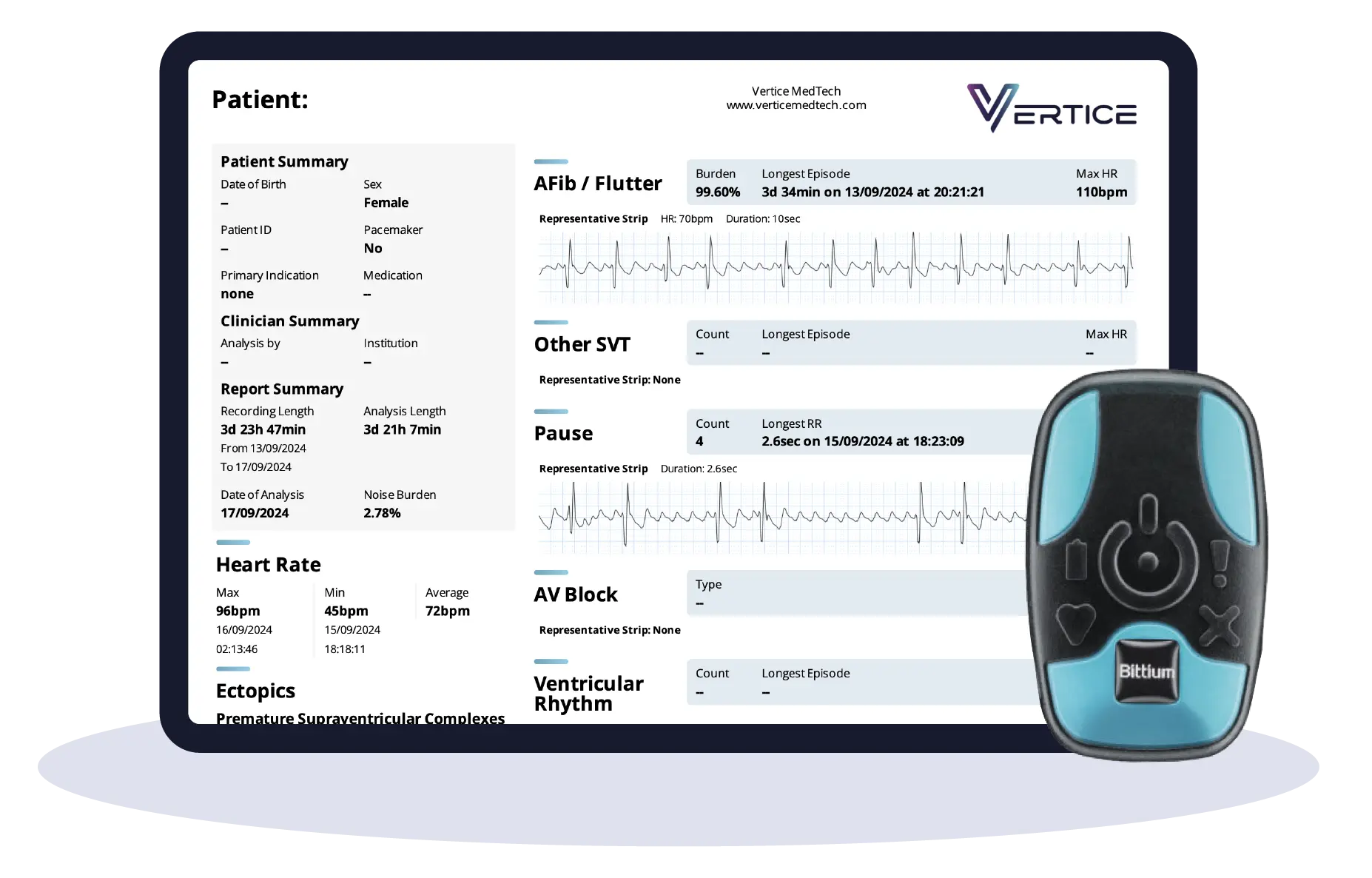 ECG Holter - Heart Recording - Image 2